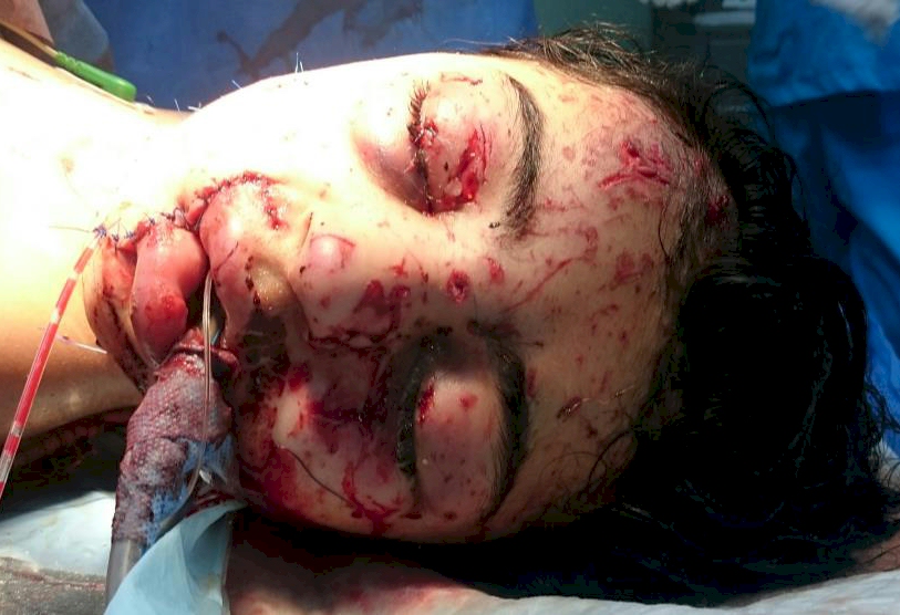 Global Tolerance for Death seen from Mosul